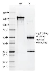 SDS-PAGE analysis of Anti-HLA A Antibody [108-2C5] under non-reduced and reduced conditions; showing intact IgG and intact heavy and light chains, respectively. SDS-PAGE analysis confirms the integrity and purity of the antibody