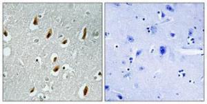 Immunohistochemical analysis of paraffin-embedded human brain using Anti-APC6 Antibody 1:100 (4°C overnight). The right hand panel represents a negative control, where the antibody was pre-incubated with the immunising peptide.