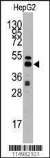 Anti-ACHY Rabbit Polyclonal Antibody