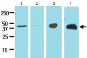 Anti-TREM2 Mouse Monoclonal Antibody [clone: 2B5]