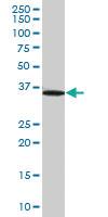 Anti-UROD Mouse Polyclonal Antibody