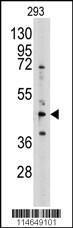 Anti-ACHY Rabbit Polyclonal Antibody