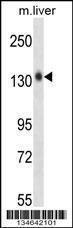 Anti-MST1R Rabbit Polyclonal Antibody (APC (Allophycocyanin))