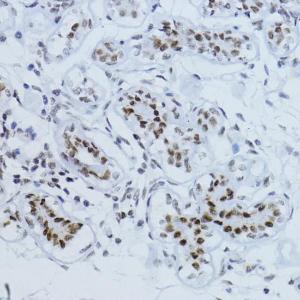 Immunohistochemistry analysis of paraffin-embedded human breast tissue using Anti-Smad2 (phospho Thr220) Antibody (A93028) at a dilution of 1:100 (40X lens)