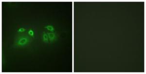 Antibody anti-arrestin 1 100 µg