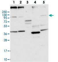 Anti-ANO6 Rabbit Polyclonal Antibody