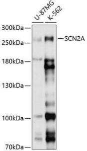 Western blot analysis of extracts of various cell lines, using Anti-SCN2A Antibody (A8659) at 1:1,000 dilution