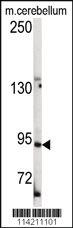 Anti-LGR5 Rabbit Polyclonal Antibody