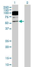 Anti-CACNB1 Mouse Polyclonal Antibody