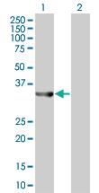 Anti-UROD Mouse Polyclonal Antibody