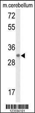 Anti-DAGLB Rabbit Polyclonal Antibody (APC (Allophycocyanin))