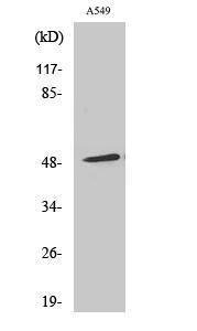 Antibody anti-arrestin 1 100 µg