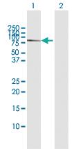 Anti-CACNB1 Rabbit Polyclonal Antibody