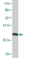 Anti-SLPI Mouse Monoclonal Antibody [clone: 3C6]