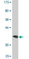 Anti-PIK3C2B Mouse Monoclonal Antibody [clone: 3E5]