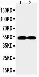 Anti-FLI1 Rabbit Polyclonal Antibody