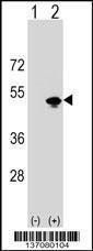 Anti-KRR1 Rabbit Polyclonal Antibody (AP (Alkaline Phosphatase))