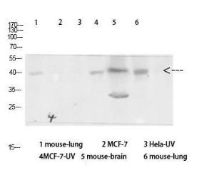 Antibody anti-arrestin 1 100 µg