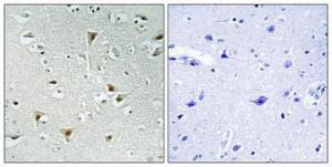 Immunohistochemical analysis of paraffin-embedded human brain using Anti-F111B Antibody 1:100 (4°C overnight). The right hand panel represents a negative control, where the antibody was pre-incubated with the immunising peptide.