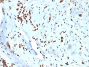 Anti-Wilms Tumor Protein Rabbit Recombinant Antibody [clone: WT1/3477R]