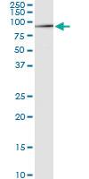 Anti-CACNB1 Rabbit Polyclonal Antibody