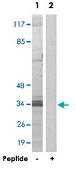 Anti-C1ORF35 Rabbit Polyclonal Antibody