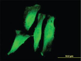 Anti-RNF11 Mouse Monoclonal Antibody [clone: 4G7]