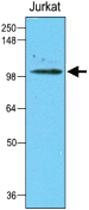 Anti-HK2 Mouse Monoclonal Antibody [clone: 1A7]