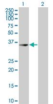 Anti-UROD Mouse Polyclonal Antibody