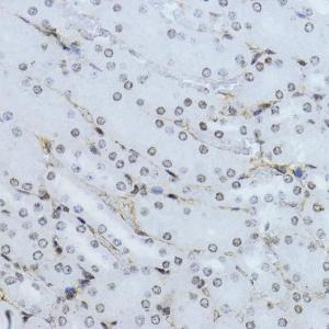 Immunohistochemistry analysis of paraffin-embedded mouse kidney using Anti-Smad2 (phospho Thr220) Antibody (A93028) at a dilution of 1:100 (40X lens)