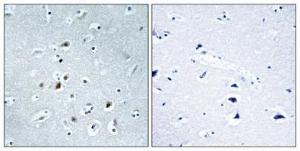 Immunohistochemical analysis of paraffin-embedded human brain using Anti-AP2C Antibody 1:100 (4°C overnight). The right hand panel represents a negative control, where the antibody was pre-incubated with the immunising peptide