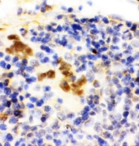 Anti-FLI1 Rabbit Polyclonal Antibody