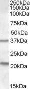 Anti-TUSC3 Antibody (A83328) (1 µg/ml) staining of Human Liver lysate (35 µg protein in RIPA buffer). Primary incubation was 1 hour. Detected by chemilu minescence