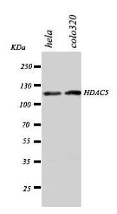 Anti-HDAC5 Rabbit Polyclonal Antibody