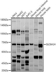 Western blot analysis of extracts of various cell lines, using Anti-SLC6A14 Antibody (A8662) at 1:1,000 dilution. The secondary antibody was Goat Anti-Rabbit IgG H&L Antibody (HRP) at 1:10,000 dilution. Lysates/proteins were present at 25µg per lane.