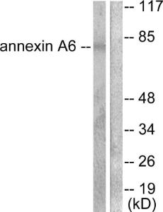 Western blot analysis of lysates from 293 cells using Anti-Annexin A6 Antibody The right hand lane represents a negative control, where the antibody is blocked by the immunising peptide