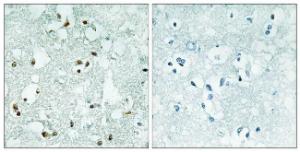 Immunohistochemical analysis of paraffin-embedded human brain using Anti-ELAC2 Antibody. The right hand panel represents a negative control, where the Antibody was pre-incubated with the immunising peptide