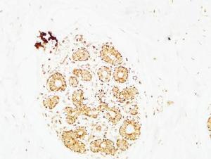 Immunohistochemical analysis of paraffin-embedded human breast using Anti-AP2C Antibody