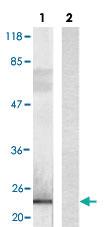 Anti-DYKDDDDK tag Monoclonal Antibody [clone: G191]