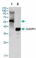 Anti-MATK Mouse Monoclonal Antibody [clone: 9D7]