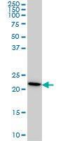 Anti-RPS7 Mouse Monoclonal Antibody [clone: 3G4]