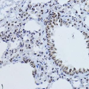 Immunohistochemistry analysis of paraffin-embedded rat lung using Anti-Smad2 (phospho Thr220) Antibody (A93028) at a dilution of 1:100 (40X lens)