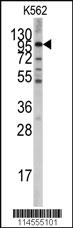 Anti-LGR5 (GPR49) Rabbit Polyclonal Antibody