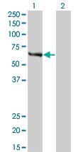 Anti-FANCC Mouse Monoclonal Antibody [clone: 6E7]