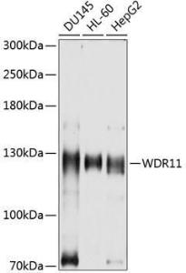 Anti-WDR11 Antibody (A8664)