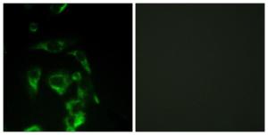 Immunofluorescence analysis of HeLa cells using Anti-eIF4G Antibody. The right hand panel represents a negative control, where the Antibody was pre-incubated with the immunising peptide