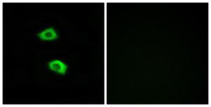 Immunofluorescence analysis of LOVO cells using Anti-OR51B5 Antibody. The right hand panel represents a negative control, where the antibody was pre-incubated with the immunising peptide.