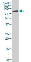 Anti-CACNB2 Mouse Polyclonal Antibody