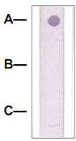 Anti-CTNNB1 Rabbit Polyclonal Antibody