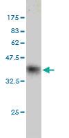 Anti-HOPX Mouse Monoclonal Antibody [clone: 3D6]